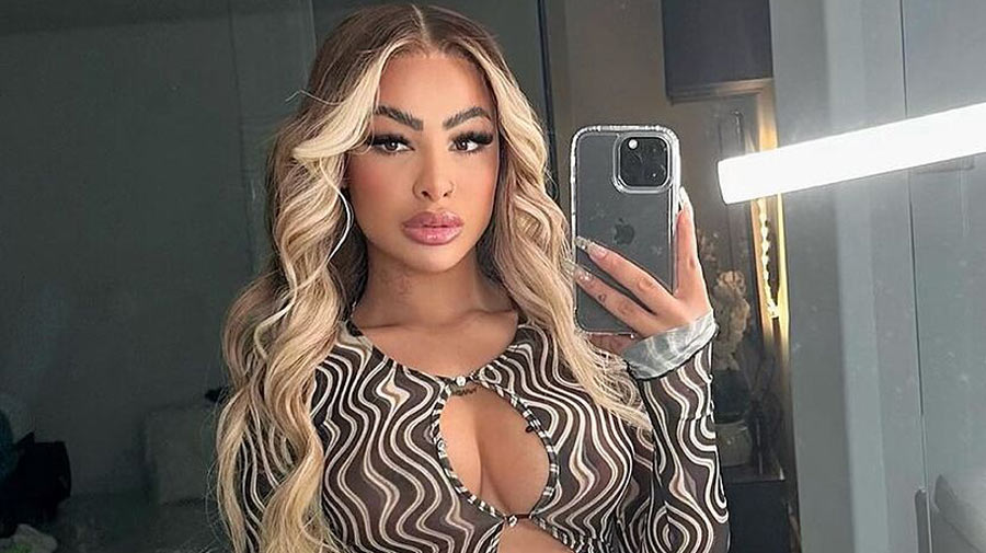 Yailin La Más Viral reapareció con múltiples golpes en su cara (+Foto)